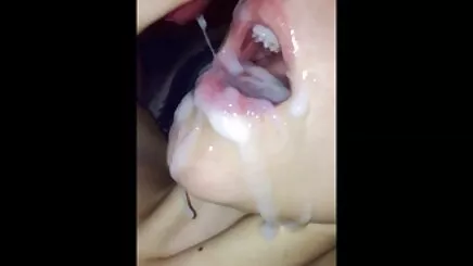 MS